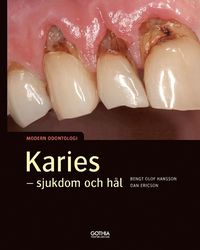 Karies : sjukdom och hål